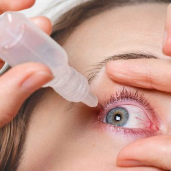 close-up-female-pours-drops-in-red-eye-has-conjuctivitis-or-glaucoma-bad-eyesight-and-pain-eyes-pain-treatment-concept-woman-cures-red-blood-eye