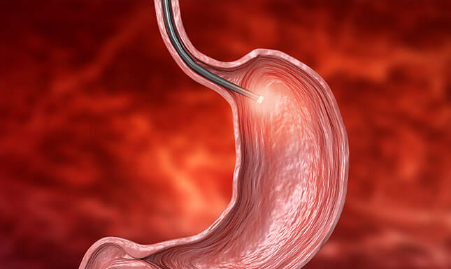 Gastroenterología