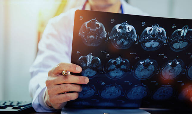 Neurología